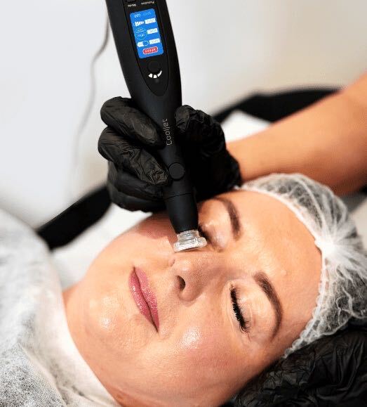 Fusion plasma stamping applicator used during a facial treatment